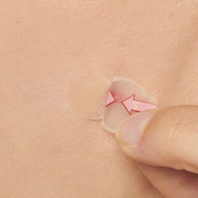 Load image into Gallery viewer, [GGD] NICO Medical SPOT PATCH POUCH
